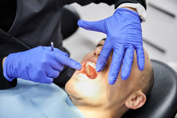 Best Emergency Dentist for Knocked-Out Tooth in Goose Creek Village, VA