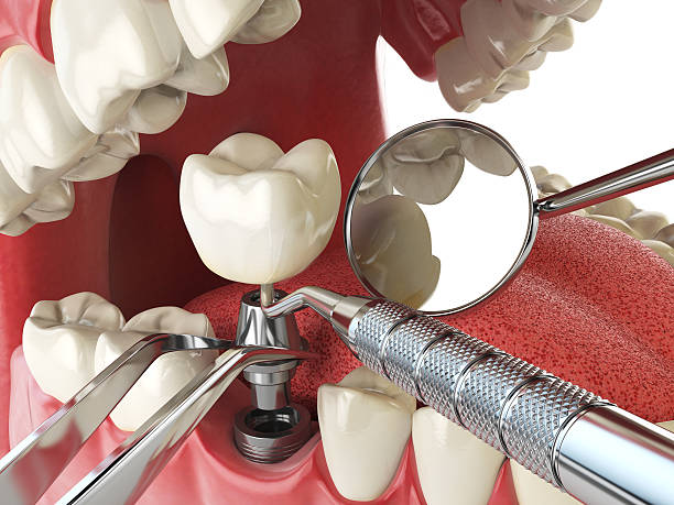 Best Orthodontic Emergency Dentist in Goose Creek Village, VA